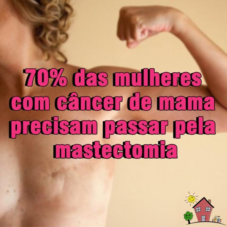 70% DAS MULHERES COM CÂNCER DE MAMA PRECISAM PASSAR PELA MASTECTOMIA