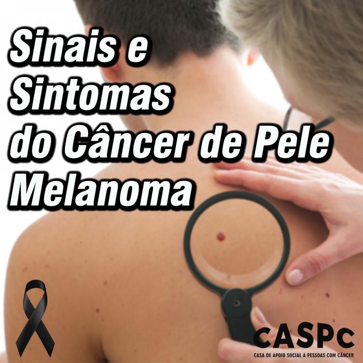 CANCÊR DE PELE MELANOMA / SINTOMAS E SINAIS